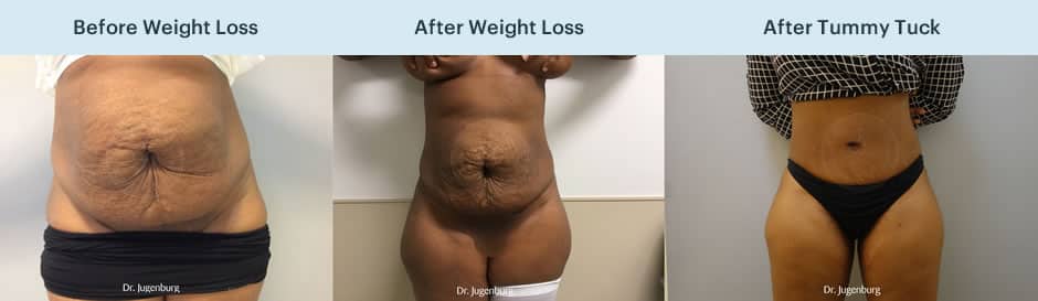 Sixsurgery weight loss image