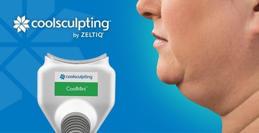 coolsculpting by zeltiq machine double chin