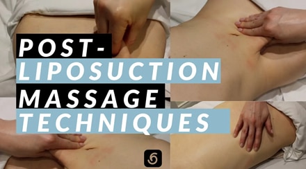 Post-Liposuction Massage Techniques