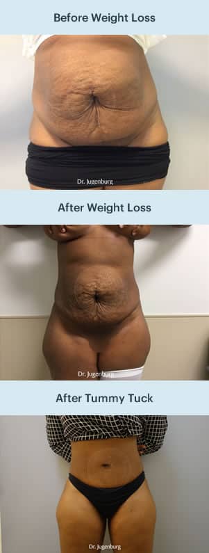 Sixsurgery weight loss mobile