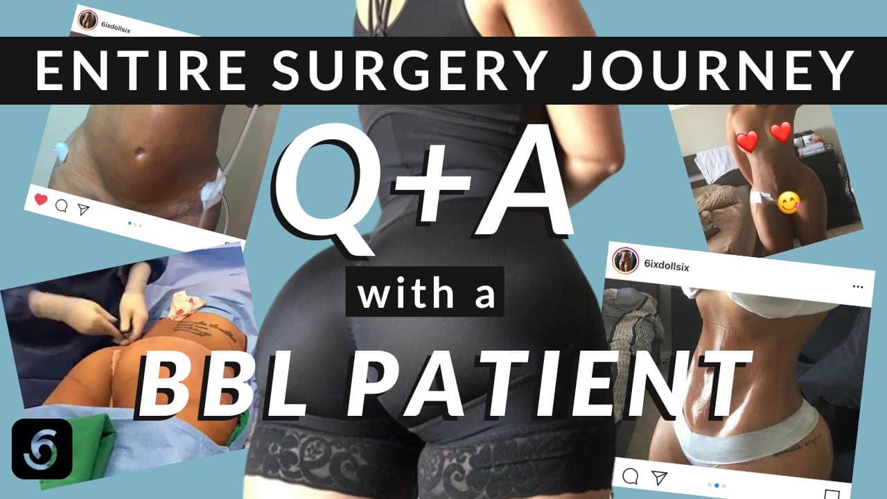 Patient Journey Interview: Brazilian Butt Lift