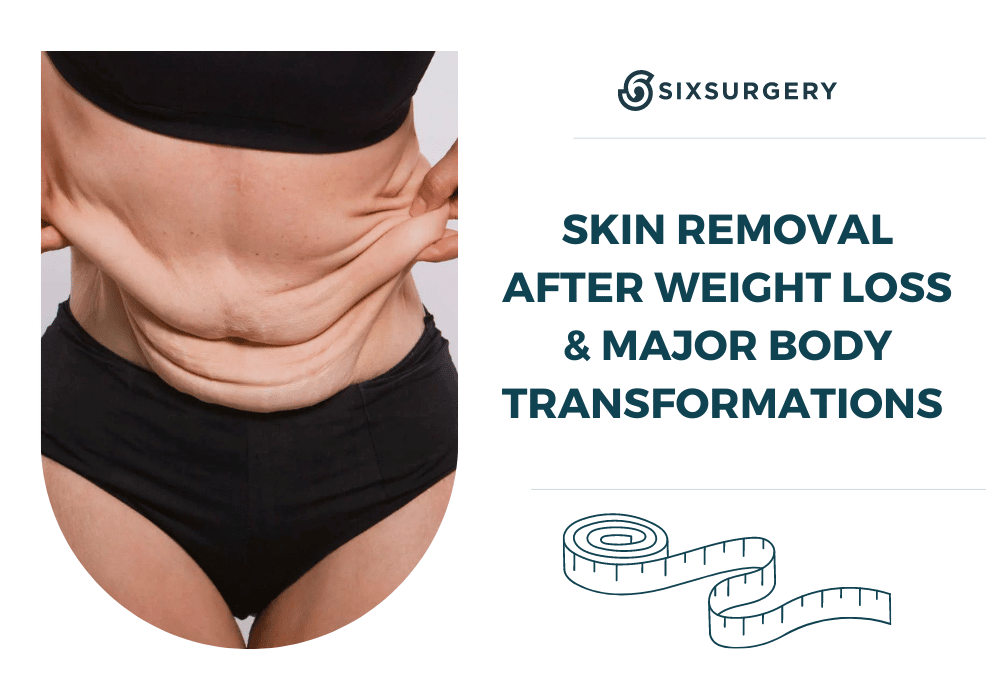 Skin removal surgery after weight loss