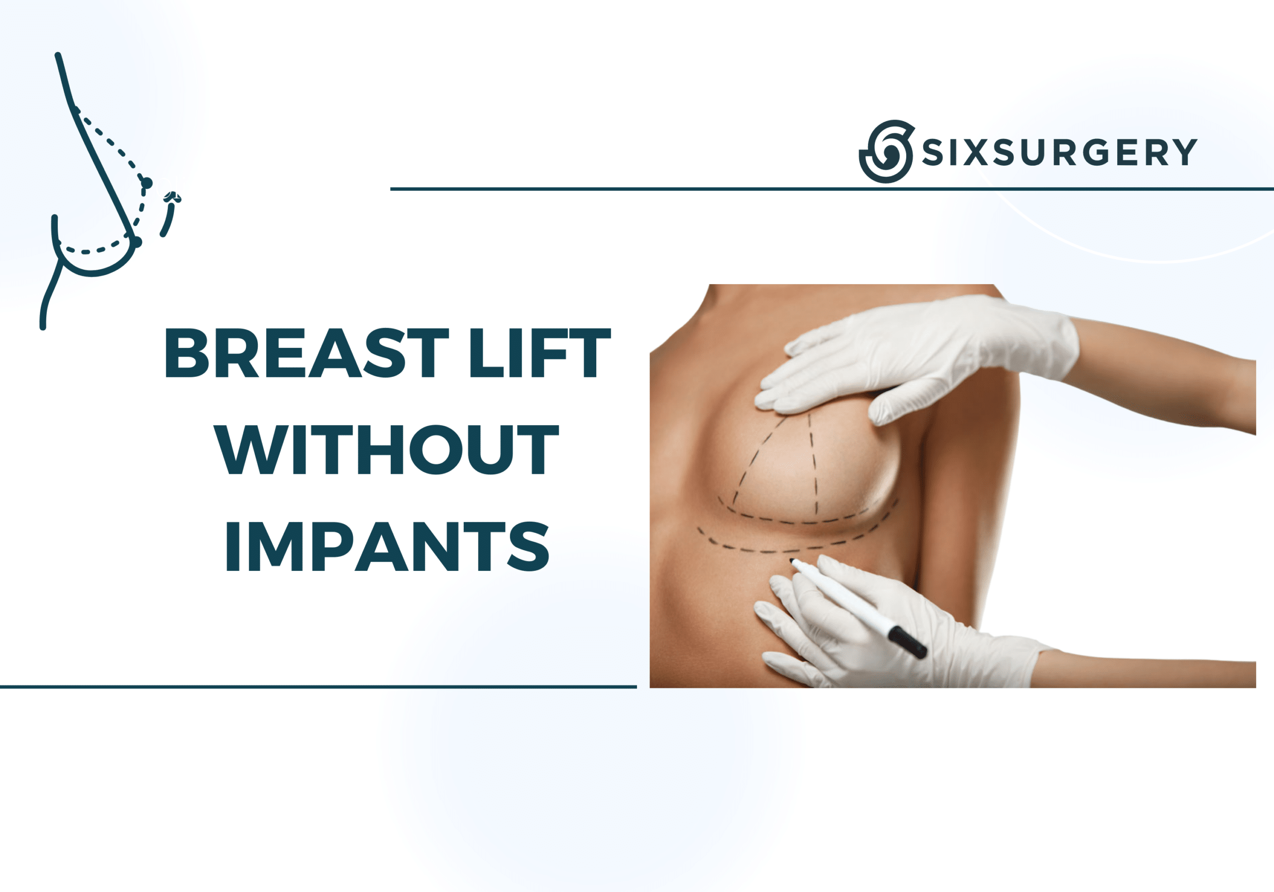 breast lift with or without implants