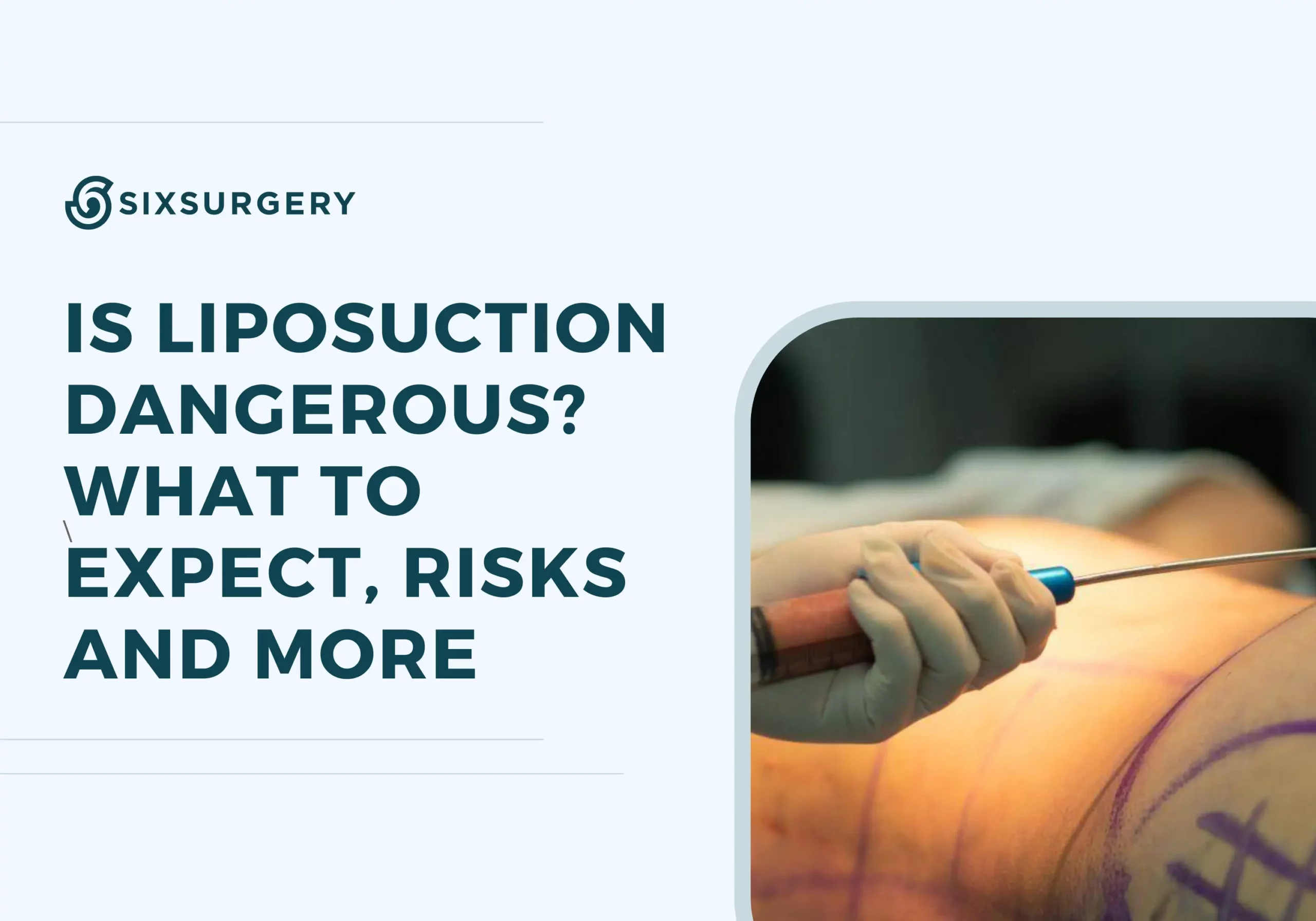 Is Liposuction Safe? What to Expect, Risks, and More