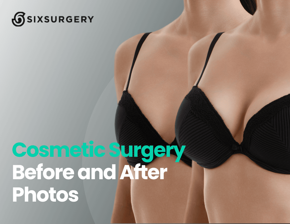 cosmetic surgery before and after photo guide