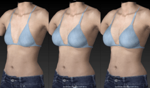 3d imaging breasts